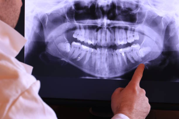 Best Broken or Cracked Tooth Emergency Dentist in Templeton, CA